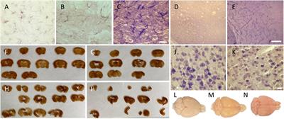 Antigenicity is preserved with fixative solutions used in human gross anatomy: A mice brain immunohistochemistry study